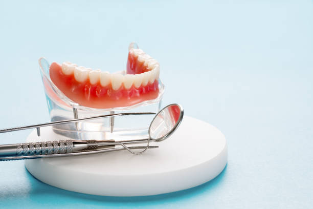 Full Mouth Reconstruction in Walnut Creek, NC